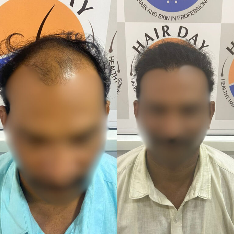 Hair Day skin and hair treatment (1)