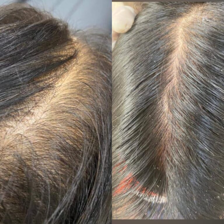 Hair Day skin and hair treatment (11)