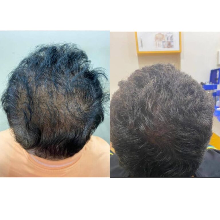 Hair Day skin and hair treatment (13)