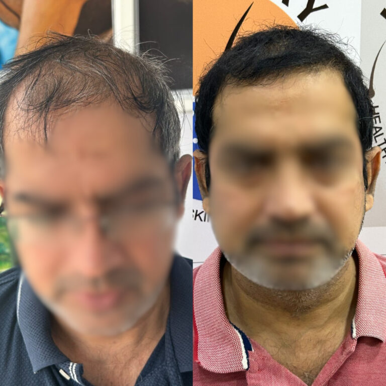 Hair Day skin and hair treatment (2)