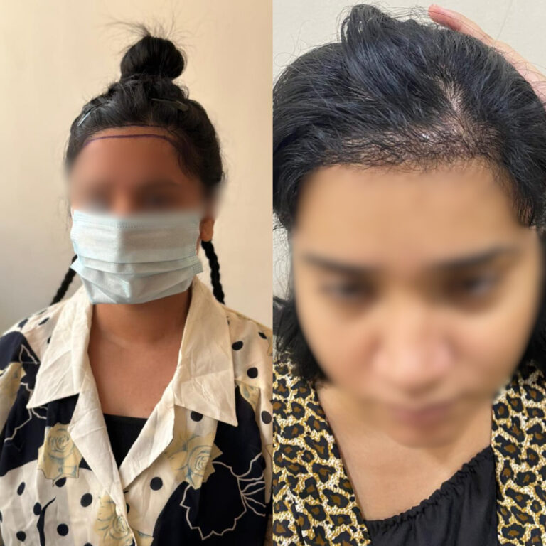 Hair Day skin and hair treatment (3)