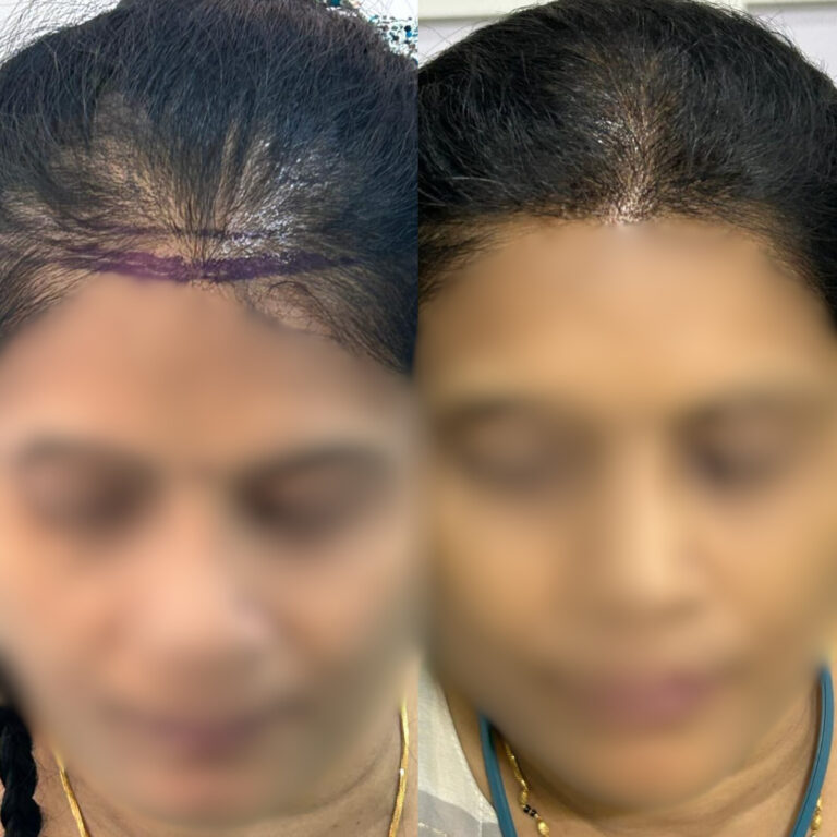 Hair Day skin and hair treatment (4)