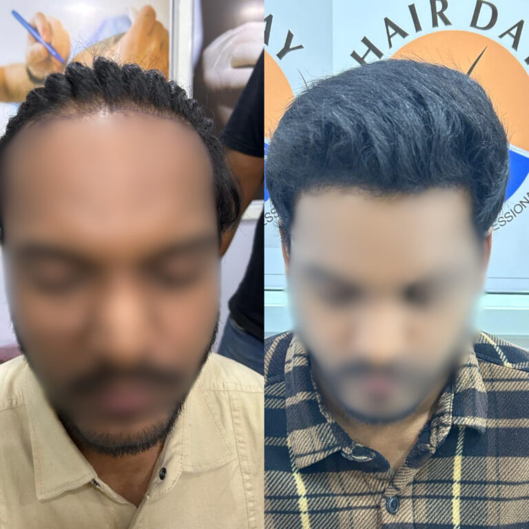 Hair Day skin and hair treatment (6)